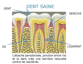 dent saine 