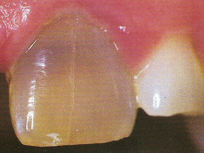  Crédit photos Dentsply